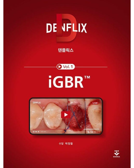 덴플릭스 Vol 1 : iGBR